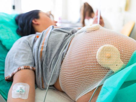 Sex After Cesarean Birth Sex After Cesarean Birth