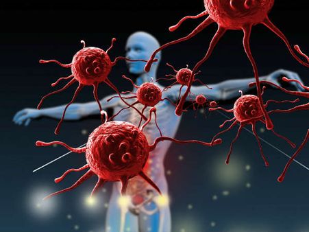 10. Inflammatory diseases