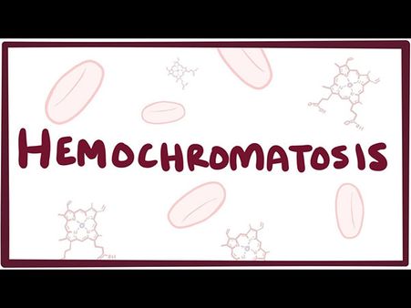 3. Hemochromatosis