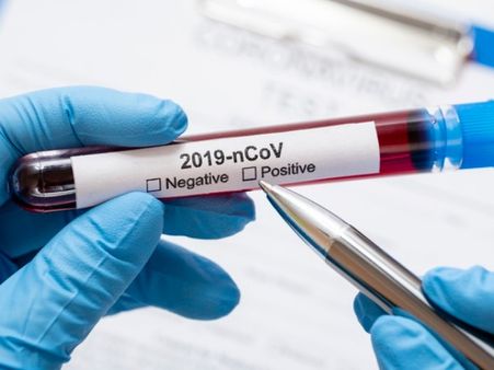 7. What should I do if I think I may have coronavirus or been exposed? 7. What should I do if I think I may have coronavirus or been exposed?