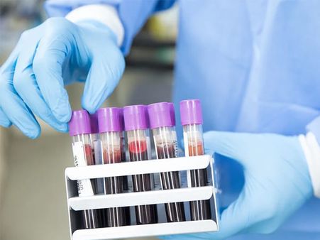 Where Has Pooled Testing Been Conducted In India?