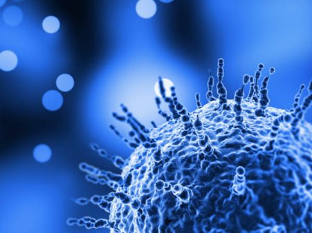 What Is Severe Acute Respiratory Syndrome (SARS)?