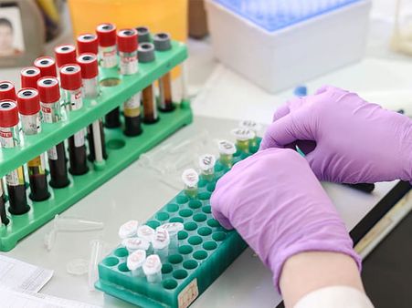 Where Should Pooled Testing Be Used?