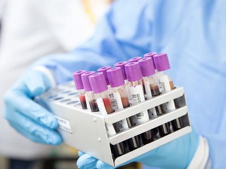 Pooled Testing For Other Diseases