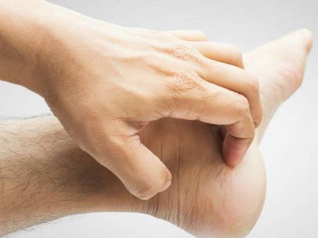 Complications Of Athlete’s Foot