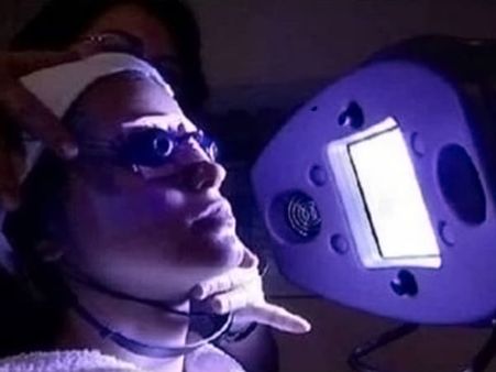 Treatment Of Psoriasis 