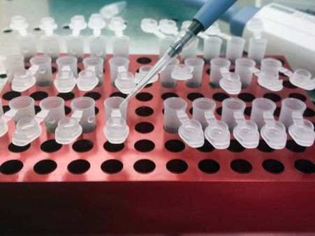 Diagnosis Of Influenza A and B Viruses Diagnosis Of Influenza A and B Viruses