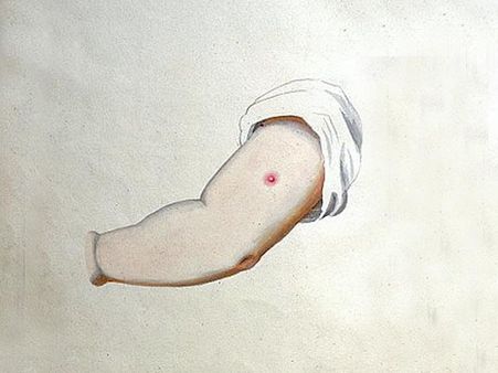 How Was Smallpox Controlled Earlier? How Was Smallpox Controlled Earlier?