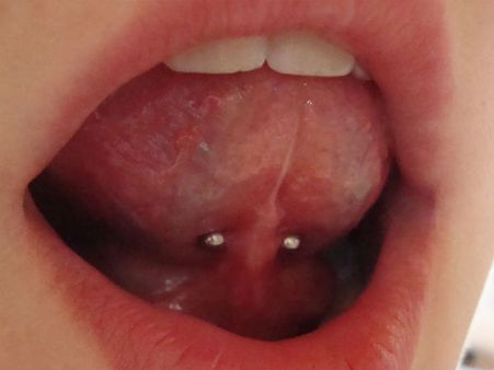 Risks Of Tongue Piercing 
