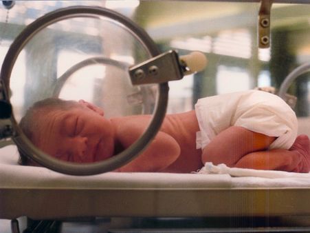 Symptoms Of Congenital Cytomegalovirus (CMV) Infection 