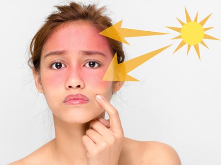 Sun Can Harm Your Skin Even Indoors