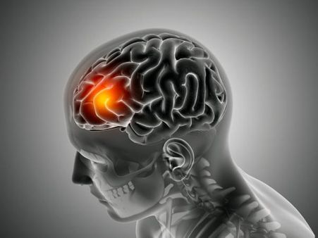 Can Brain Tumour Be Prevented?