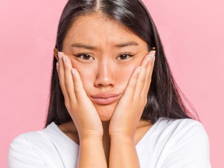 How To Get Rid Of Lip And Face Blisters (Fever Blisters)