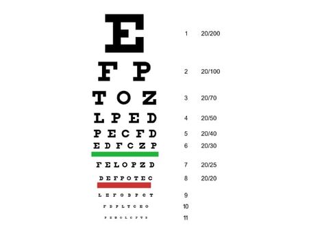Diagnosis Of Blurred Vision