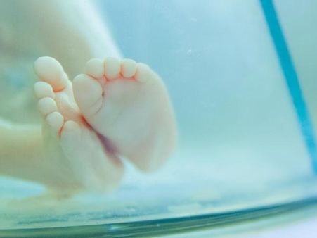 Complications Of Group B Strep Disease