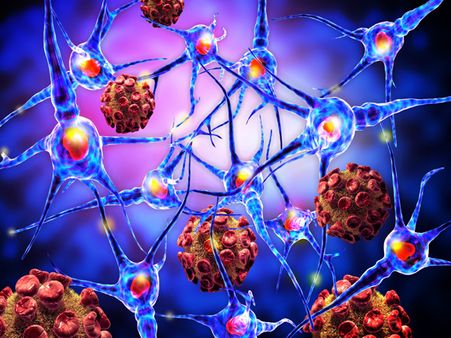 Risk Factors Of Sarcoma