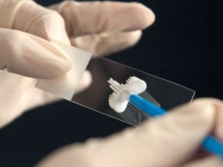 9. Go for cervical screening check-ups