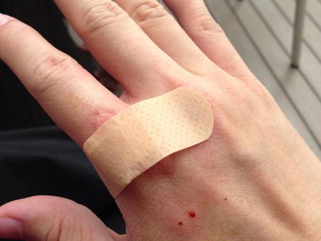 What To Do When A Dog Bites