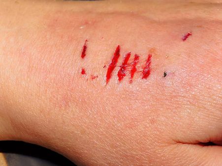 When To See A Doctor