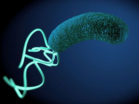 2. Bacterial infection