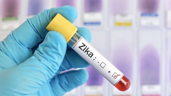 Diagnosis Of Zika Virus Infection