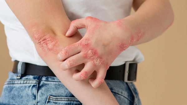 What Are The Types Of Vasculitis?