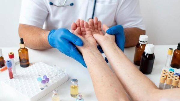 How Is Lupus Diagnosed?