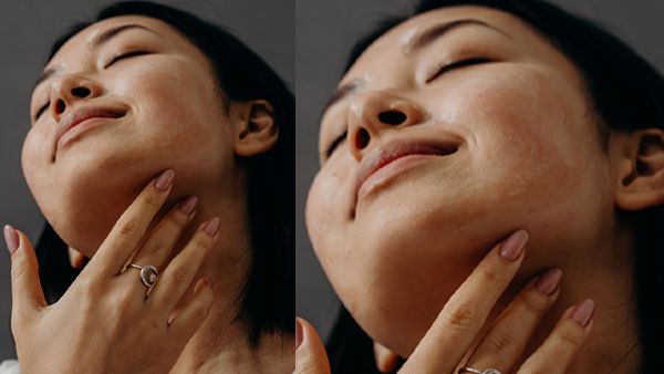 Cleanse, Tone, and Moisturise