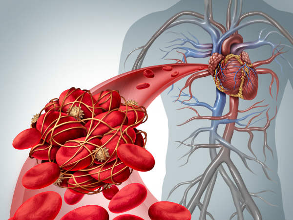 યૌન રુચિમાં ઉણપ