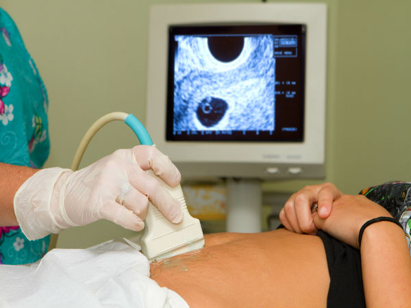 9. Cervical mucusને તપાસો: