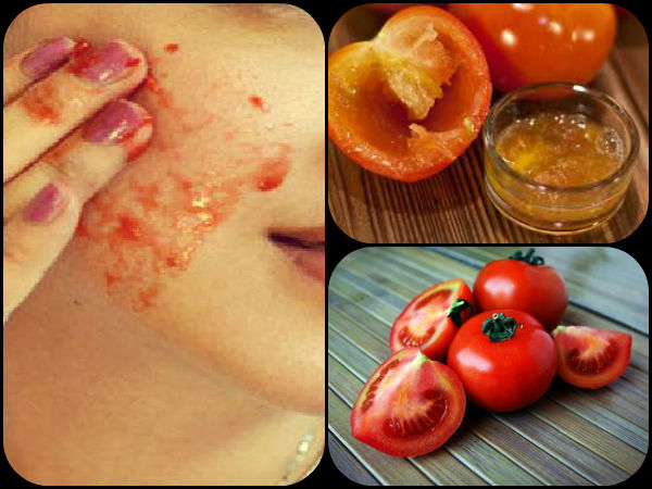 Rub A Freshly Cut Tomato On Your Face