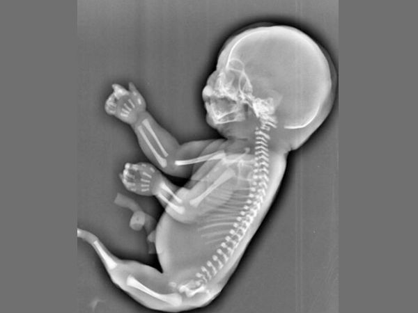 બાળકનું હૃદય :