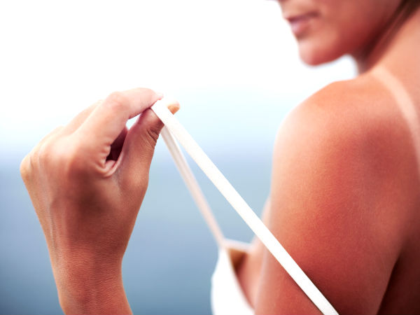 tips to treat sun tan instantly tips to treat sun tan instantly