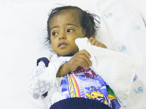  હાર્ટ સર્જરી