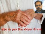अब बिना ऑपरेशन भी ठीक हो सकेगा गठिया 