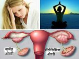 प्राकृतिक रूप से कैसे ठीक करें हार्मोन असंतुलन 