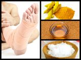  इन घरेलू नुस्‍खों से ठीक करें पैर की मोच 