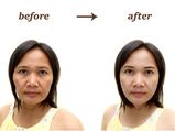 1 हफ्ते में 10 साल छोटी दिखने के लिये अपनाएं ये घरेलू उपचार 