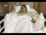 दुनिया की सबसे वजनदार महिला इमान ने किया अपना वजन कम 