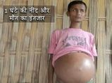 अनोखी बीमारी...1 घंटे की नींद लेकर अपनी मौत का इंतजार कर रहा है ये लड़का...