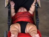  10 माह के इस बच्‍चें का वजन है 9 साल के बच्चे जितना है! 