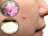 स्‍किन को तो गोरा करेंगे ही साथ में मुंहासे भी हटाएंगे ये Face Cleansers 