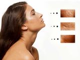  Face के इन बड़े-बड़े पोर्स को करें 5 मिनट में छोटा 