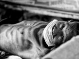 30 दिनों में करें टी.बी. का इलाज, ये हैं असरदार घरेलू उपाय 