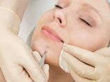 ठोड़ी पर हुए Blackheads को हटाने के घरेलू उपाय 