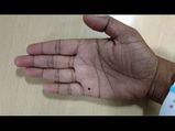 शरीर के इन हिस्सों में तिल कामयाब शादीशुदा ज़िंदगी की तरफ करती है इशारा