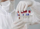Coronavirus: क्या होता है सीरो सर्वे, जो आपके आसपास के संक्रमण और एंटीबॉडीज के बारे में बताएगा 