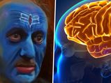 The Kashmir Files में अनुपम खेर के क‍िरदार को होती है  डिमेंशिया, जानें इसके लक्षण 