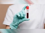 EMM Negative: गुजराती व्‍यक्ति में मिला दुर्लभ ब्लड ग्रुप, दुनिया में सिर्फ 10 लोगों का है ये  ब्‍लड ग्रुप