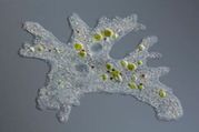 Brain-Eating Amoeba Infection : कोरोना के खौफ के बीच ब्रेन ईटिंग अमीबा, ये लक्षण दिखने के बाद हो जाती है मौत